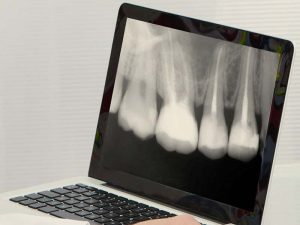 radiologia digitale