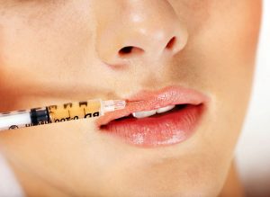 fillers
